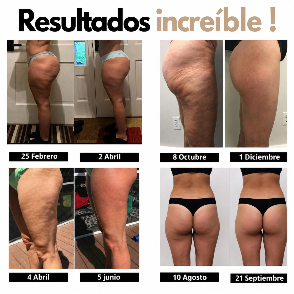 Vélora™ – Leggings anticelulíticos moldeadores 3D